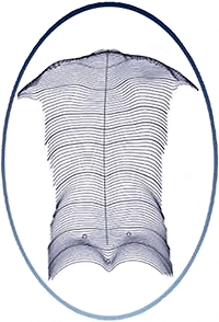 3D-Wirbels�ulenvermessung: Dynamische R�ckenuntersuchung ohne R�ntgenstrahlen