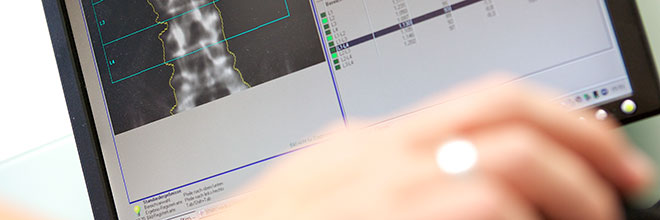 Osteoporose und Knochendichtemessung